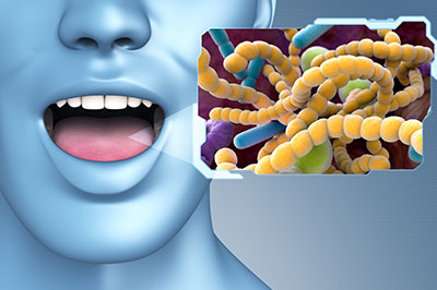 The image is a digital graphic that features an illustration of a human head with an open mouth on the left side, and a microscopic view of bacteria or germs in the center.