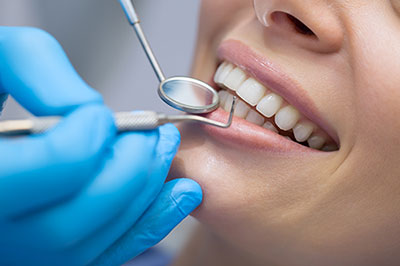 A dental professional using a dental drill to clean or repair teeth in a patient s mouth.