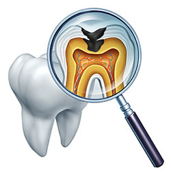 An illustration of a dental examination, showing a magnified view of an open mouth with a tooth and gum, viewed through a magnifying glass, accompanied by a detailed diagram of the tooth s internal structure, including roots and pulp.