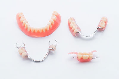 The image shows a collection of dental implants, including bridges and individual teeth, displayed on a white background.