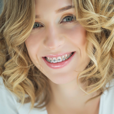 Blonde woman with braces smiling at camera, wearing a white top and curly hair.