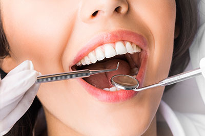 A woman with a wide smile, wearing white gloves and holding a dental instrument near her mouth.