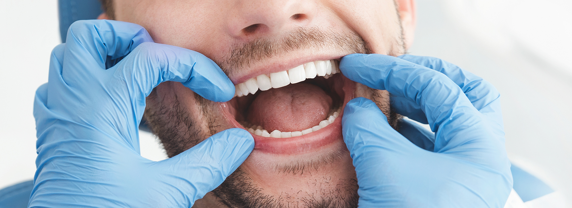 A man in a dental mask and gloves, holding his mouth open with one hand while the other hand is placed on his chin, showcasing his teeth.