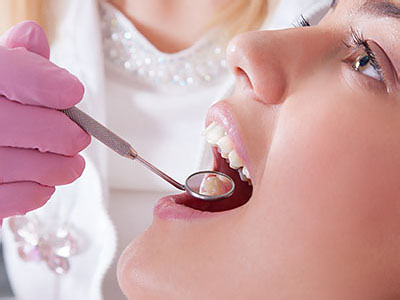 The image shows a dental professional performing a procedure on a patient s mouth, with the patient s mouth open and the dentist using a tool to work inside.