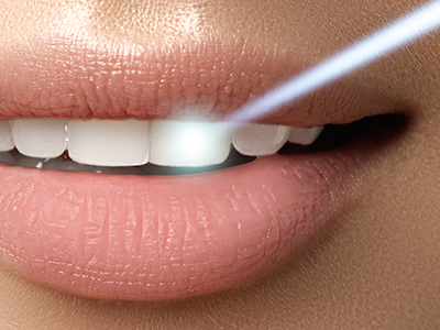 The image shows a close-up of a person s mouth with their teeth, lips, and chin visible. There is a blue light emanating from the mouth area, creating an illusion of a glowing or illuminated effect around the lips.